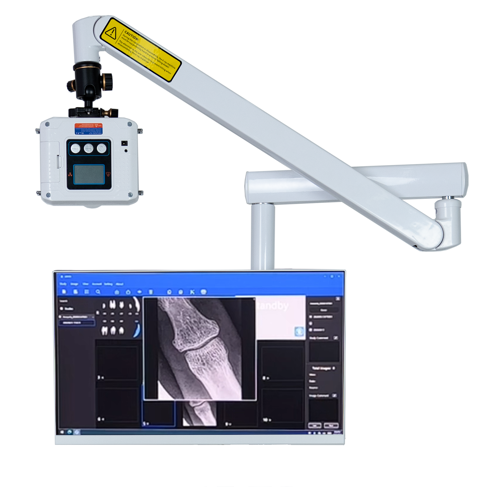 Portable Veterinary X-Ray System LCD Display and Control Interface - Close-up View